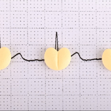 Electrocardiogram Monitoring Heart Rhythm