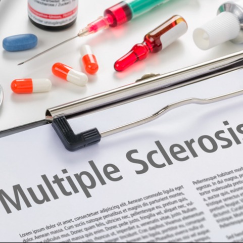 Multiple Sclerosis Diagnosis and Treatment Planning