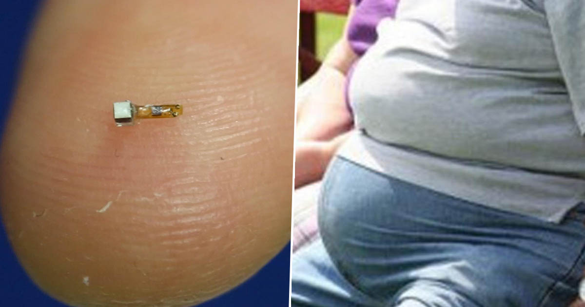 obesity1FacebookThumb