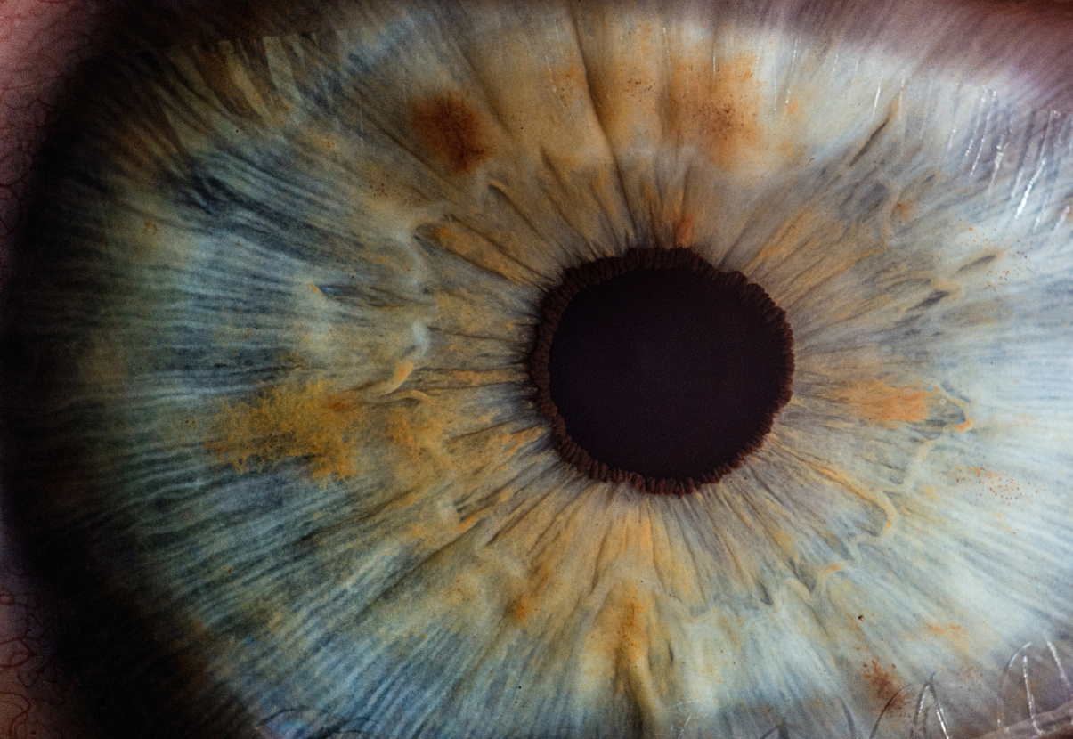 eye-1
