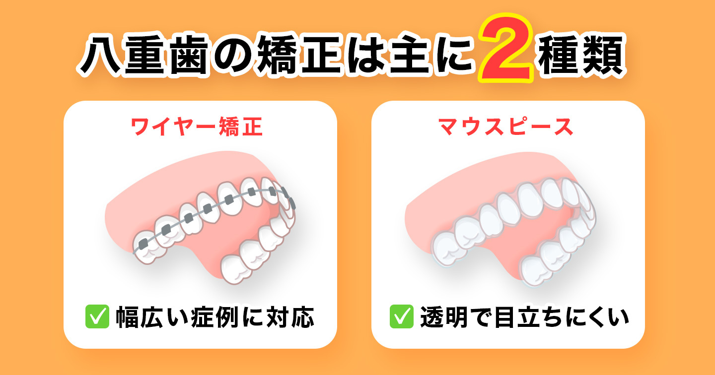 八重歯治療2種類