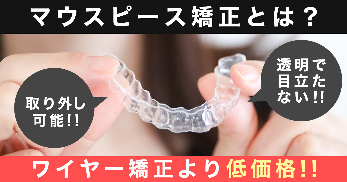 マウスピース矯正とは