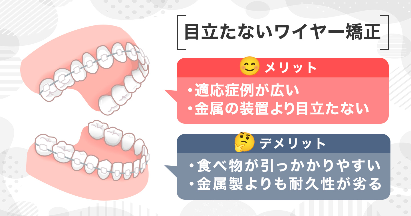 目立たないワイヤー矯正