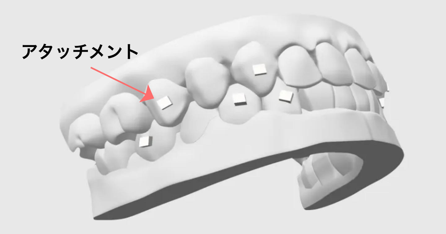 アタッチメント(エンゲージャー)をつけたとき