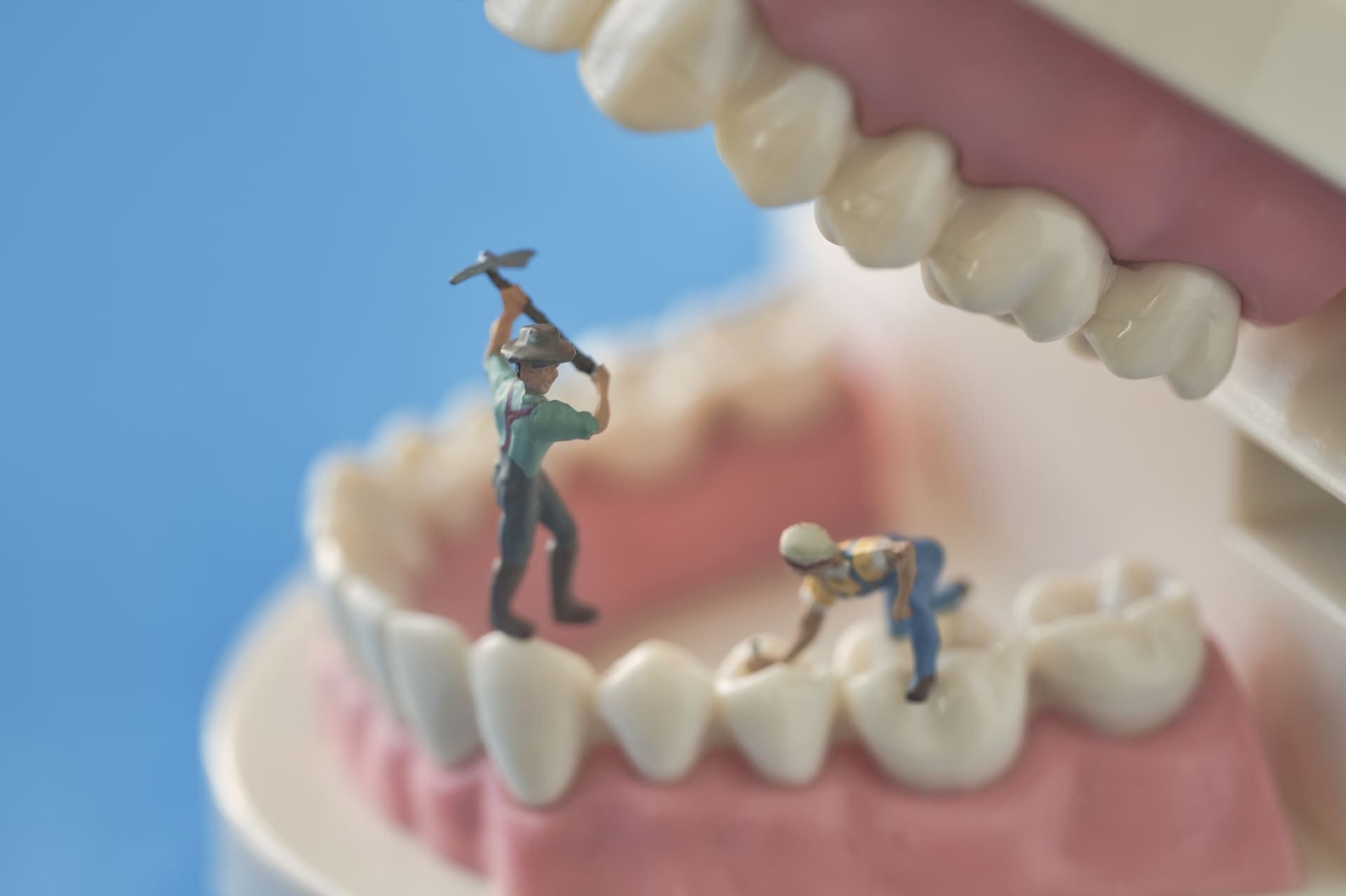セラミック矯正とは?歯科矯正との違いと起こり得るリスク