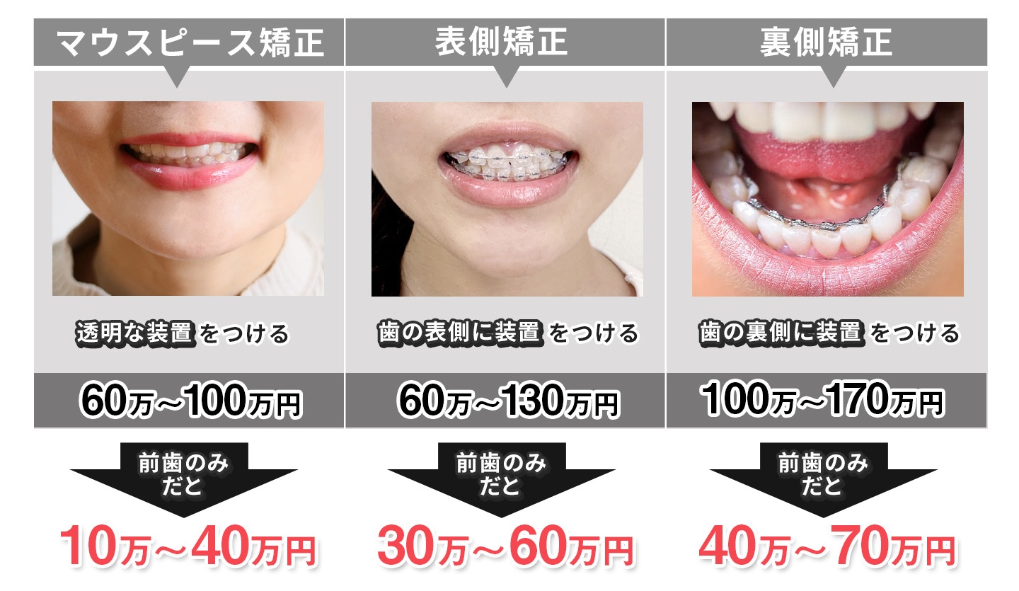 部分矯正紹介
