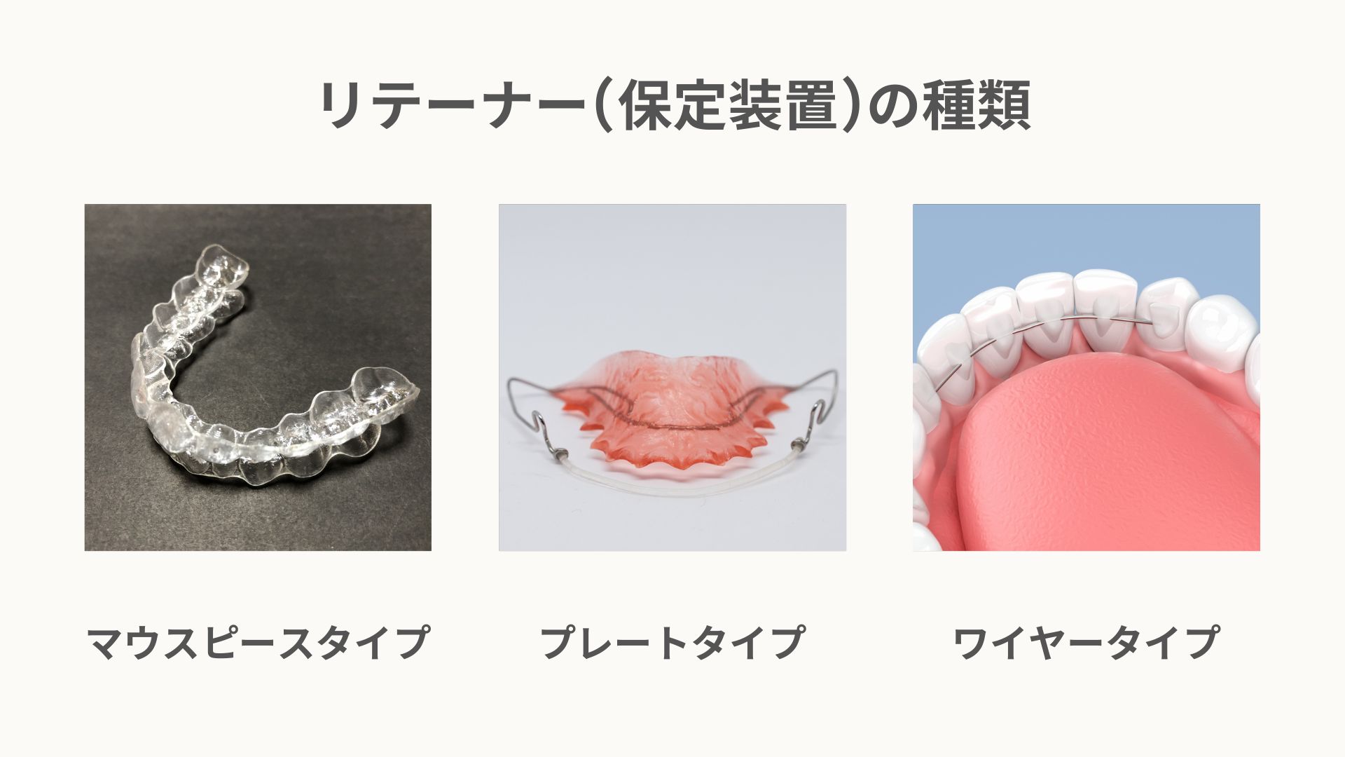 マウスピース矯正は目立つの?目立つと感じる原因や対処法も解説