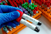 Scientist hold two test tube with blood sample for HIV type 1 and HIV type 2 antibody testing