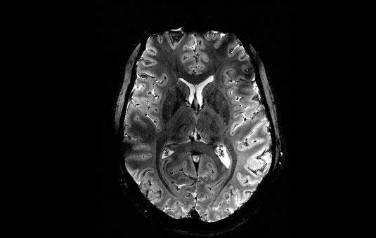 フランスCEAが開発、わずか4分で脳スキャンを完了する高性能MRI「イズールト」を公開