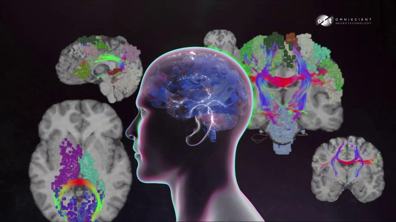 脳の神経ネットワークを細密に可視化するプラットフォーム