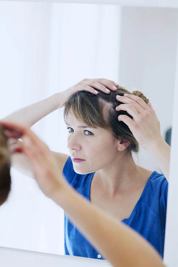 Scalp psoriasis: what is it and how to treat it?