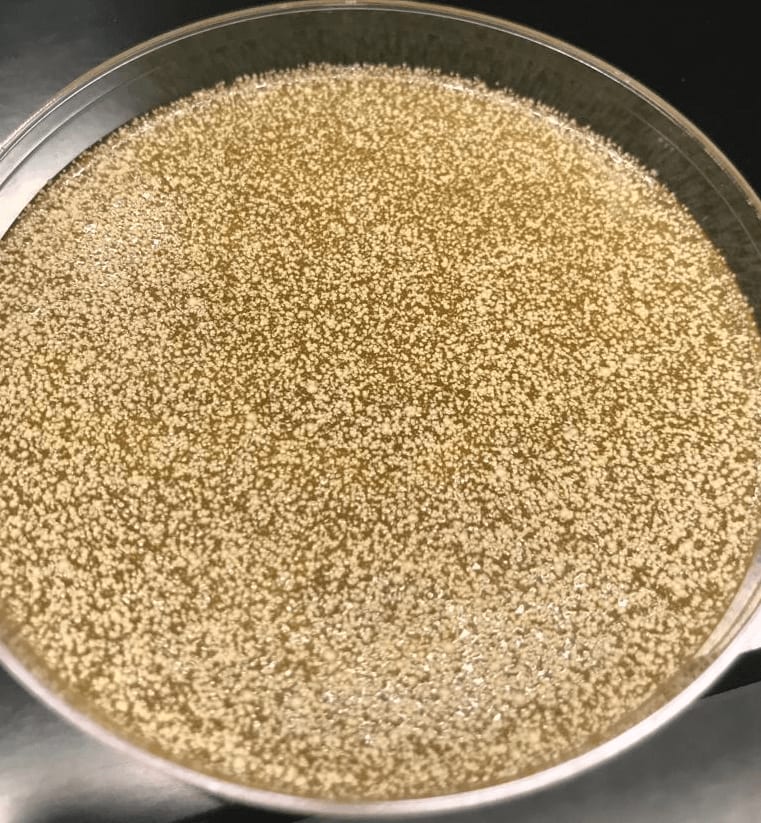 Mallasezia globosa bacteria in glass receptacle in a zoom.