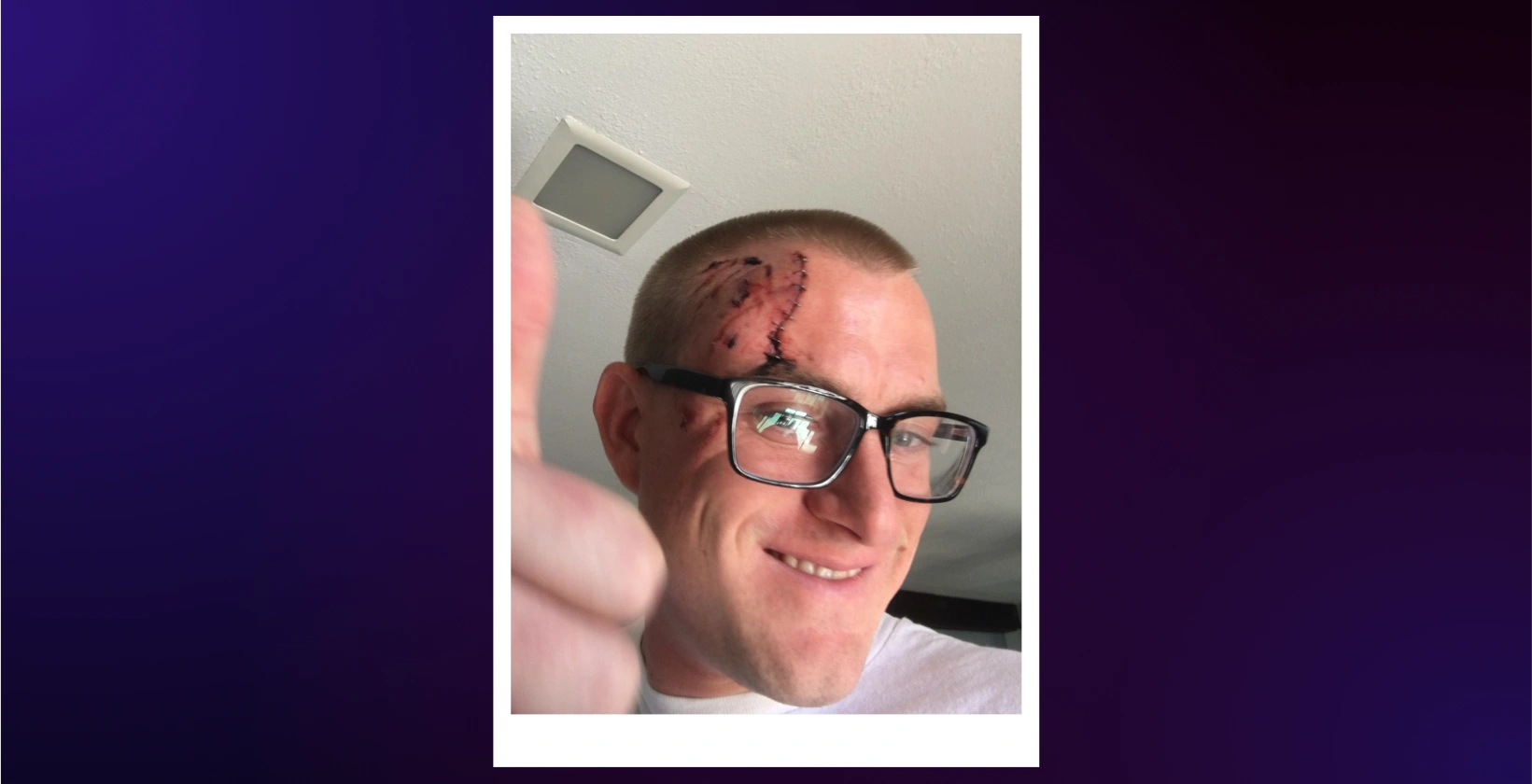 stapleface