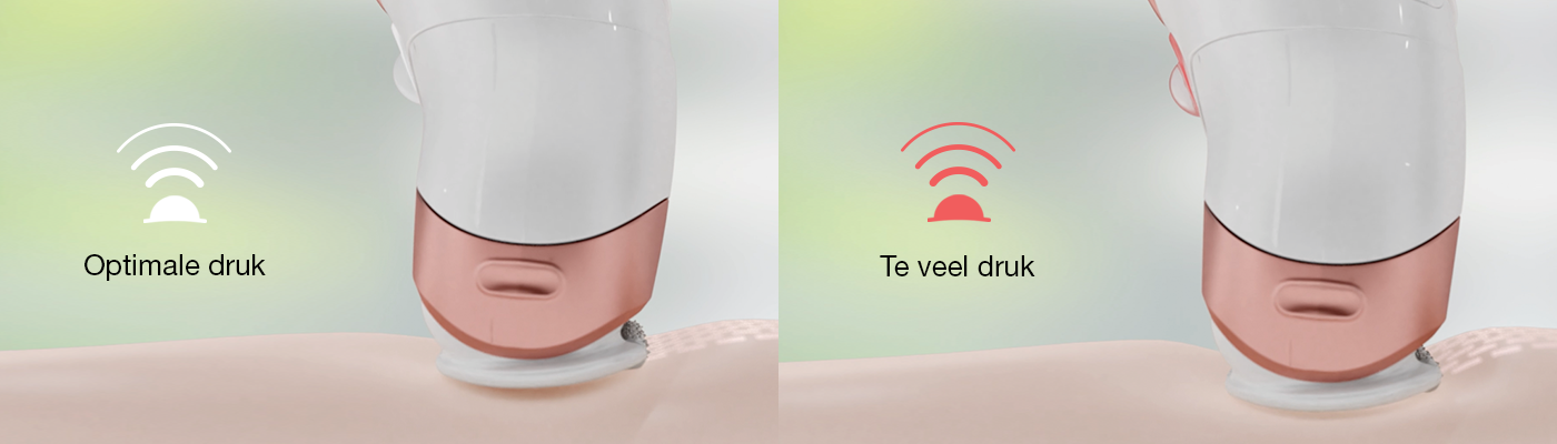 Why does an epilator with a flexible head offer a better experience for the user?