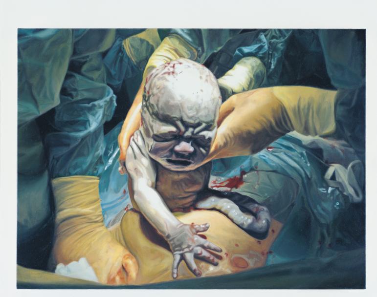 Damien hirst  birth  cyrus   2006