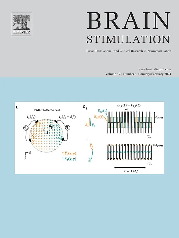Sample cover of Brain Stimulation