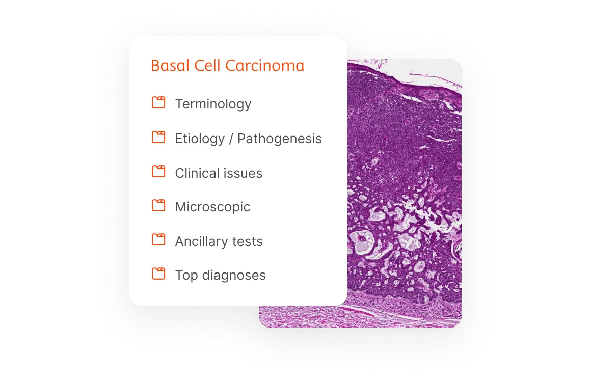 Basal Cell Carcinoma Image List Benefit