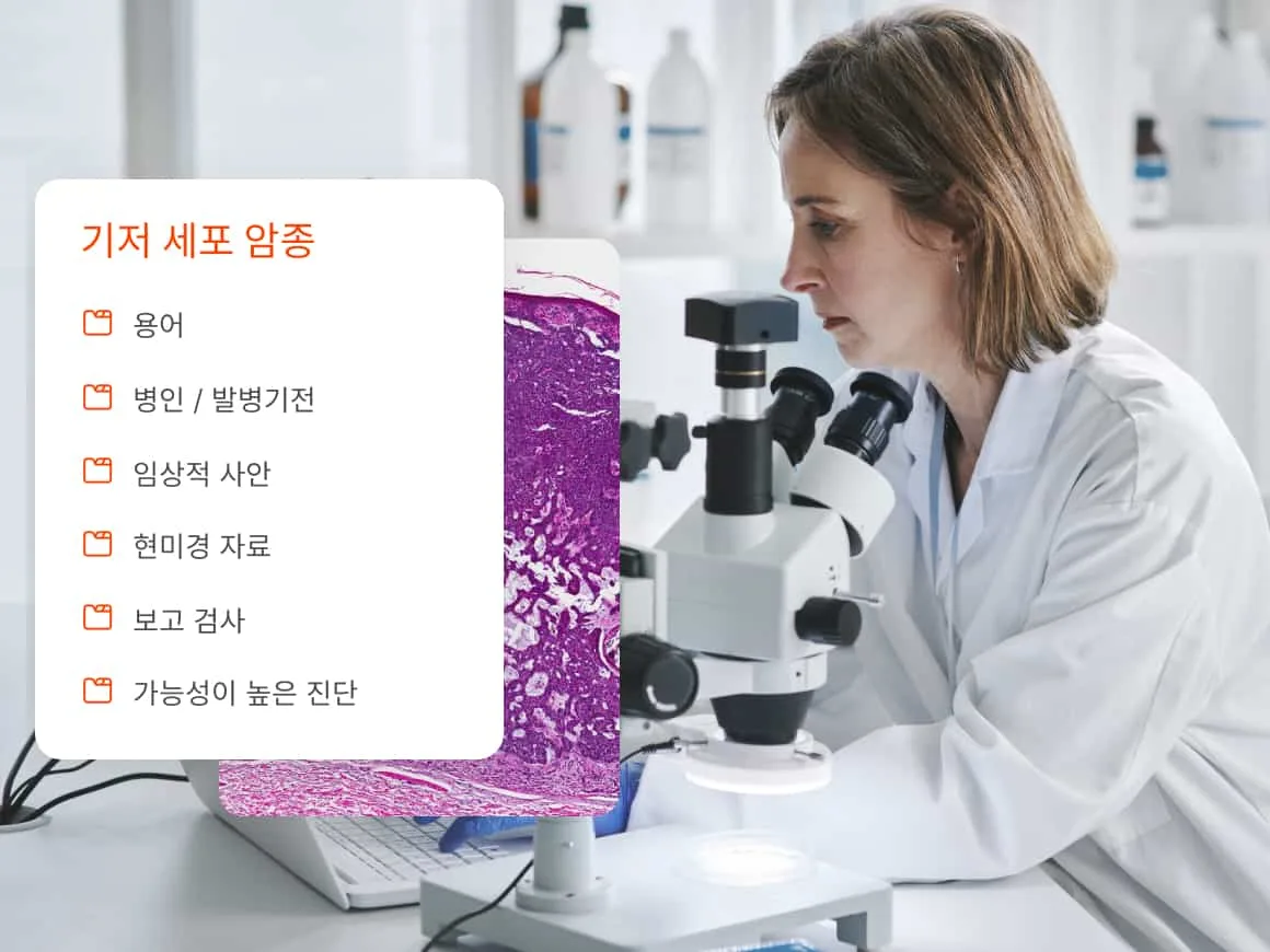 Doctor using microscope with overlay of basal cell carsinoma content