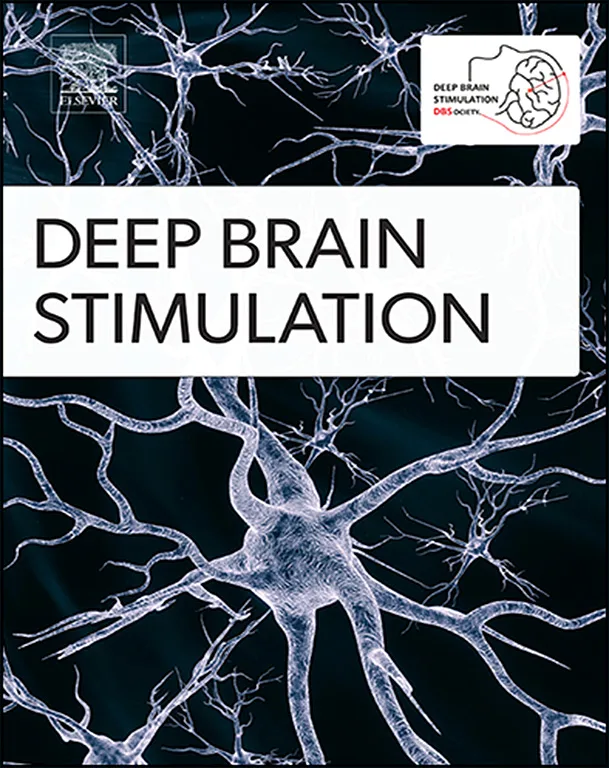 Sample cover of Deep Brain Stimulation