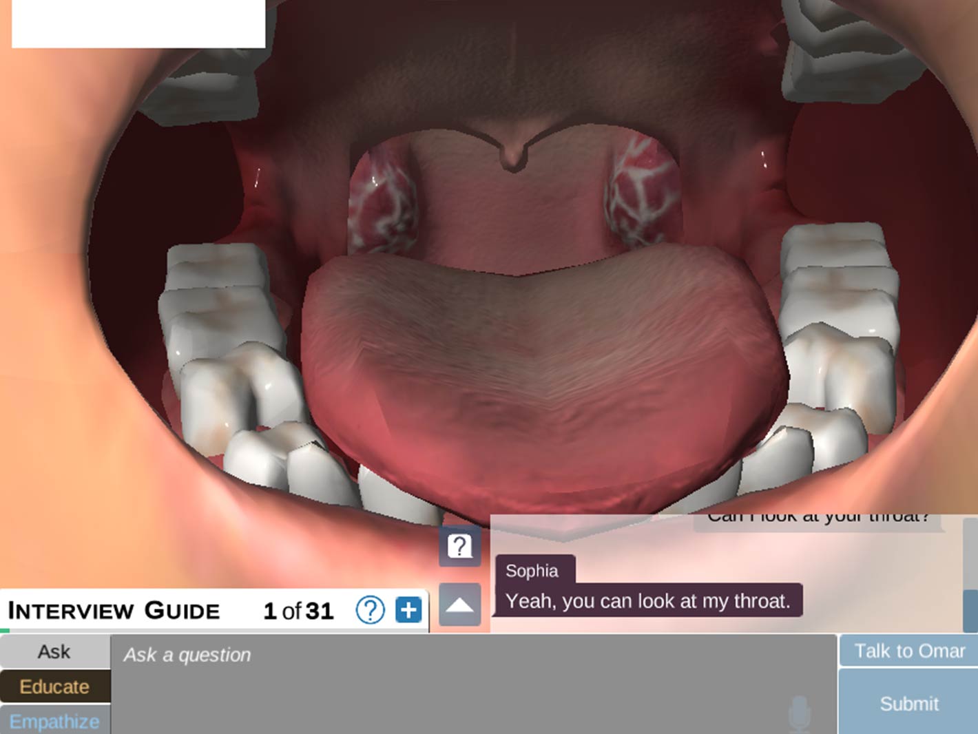 3D illustration of throat inspection