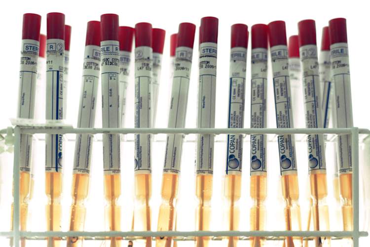 Collection of throat swab samples