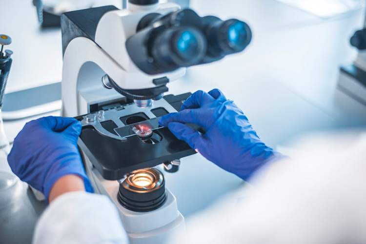 Scientist holding slide with blood sample in lab