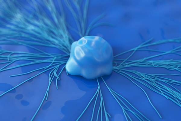 cervical cancer cell