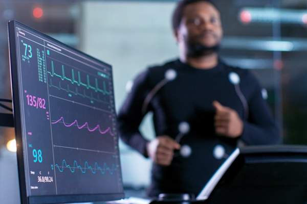 Man running on treadmill for heart monitor test