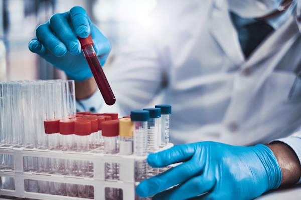 scientist examining blood sample