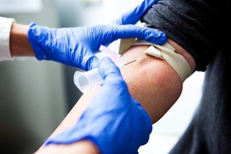 close up of man's arm getting blood drawn