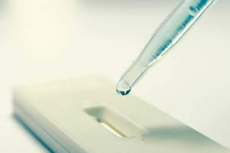 rapid hiv test