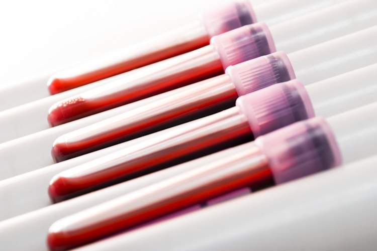 Blood samples