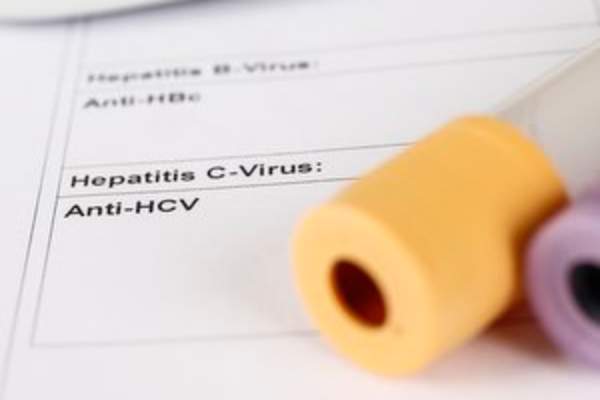 hepatitis C laboratory test results, blood tubes on paper