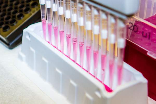 Pipette and Liquid - Scientific Research - DNA Viral Test