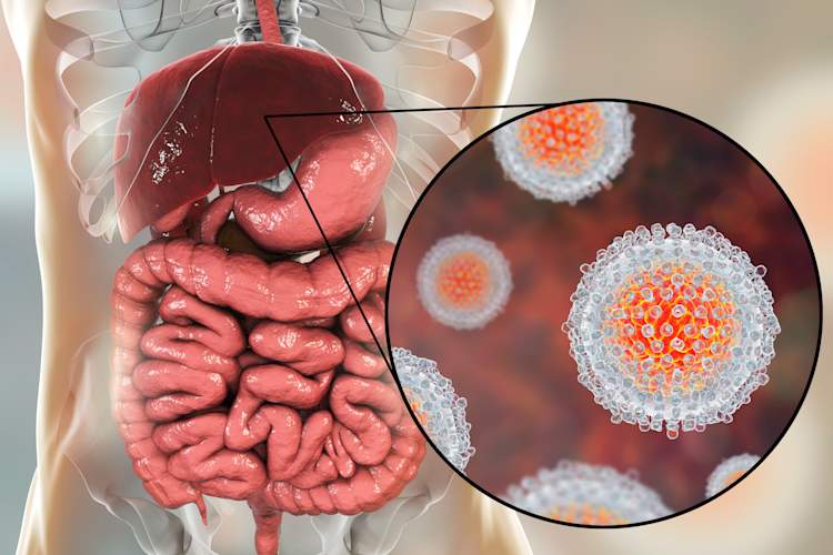 Hepatitis C