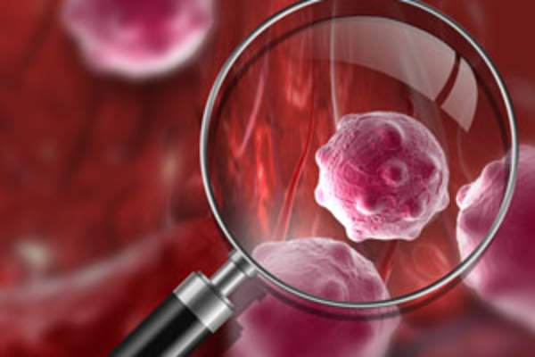 Cancer cell under magnifying glass