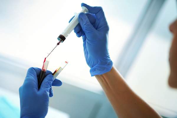 blood test