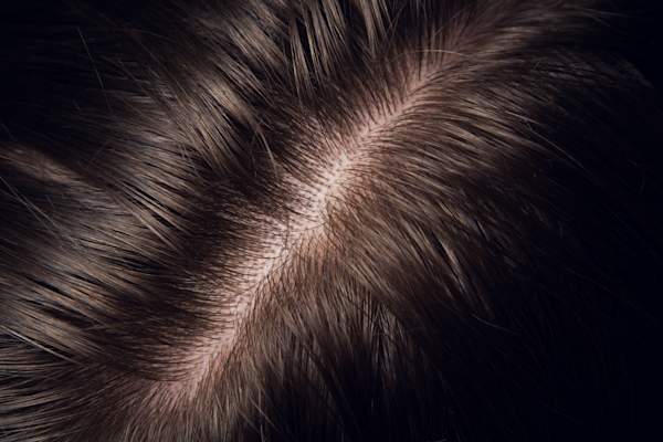 human hair