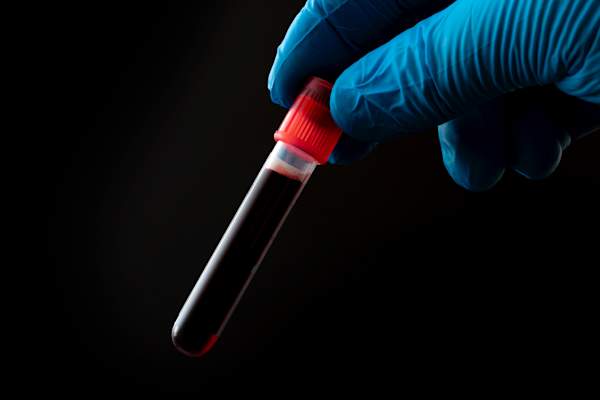 blood vial
