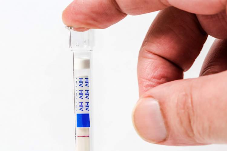 HIV self test