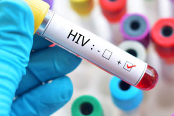 HIV test blood vial