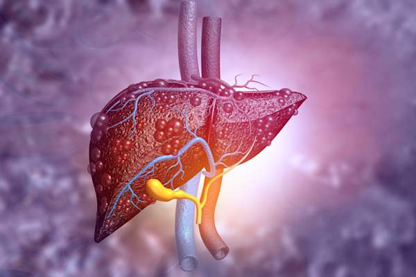 diseased liver