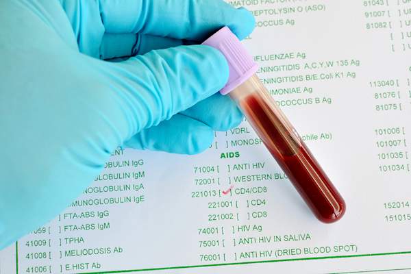CD4/CD8 Testing