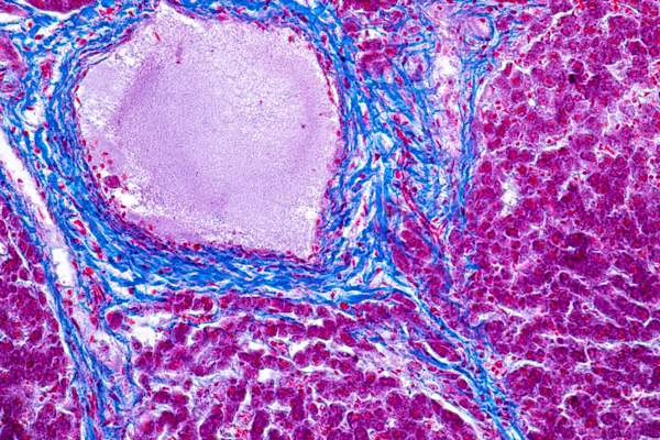 Liver tissue under microscope