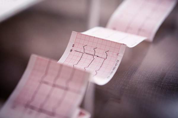 Medical cardiogram printed on paper