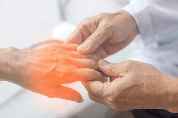 Doctor examining a patient's hand
