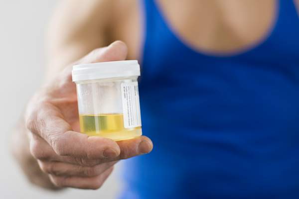 urine test