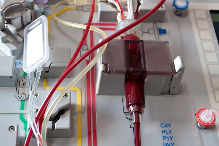 stem cell transplant device