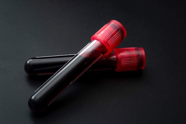 blood samples