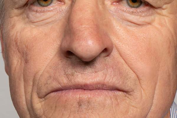nose close up